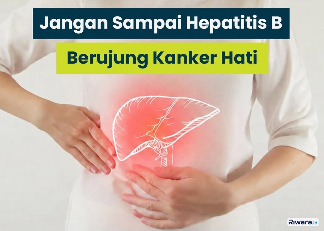 Indonesia Jadi Salah Satu Negara dengan Kasus Hepatitis B Terbanyak di Dunia, Ayo Kenali Gejalanya agar Tidak Berujung Kanker Hati